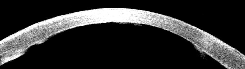 1a554c93cf6290e7bddf5adf9dc121c8.png 1a554c93cf6290e7bddf5adf9dc121c8.png